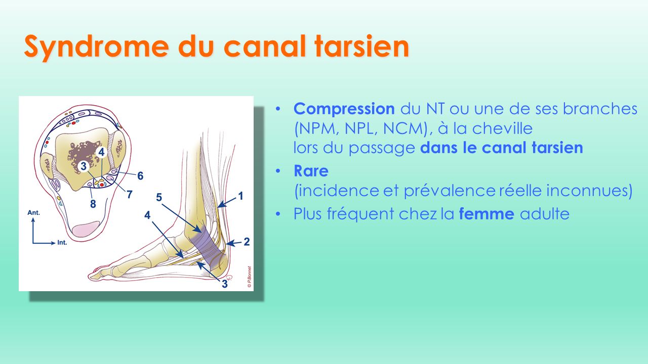 L ENMG dans les atteintes du nerf tibial et de ses branches ppt